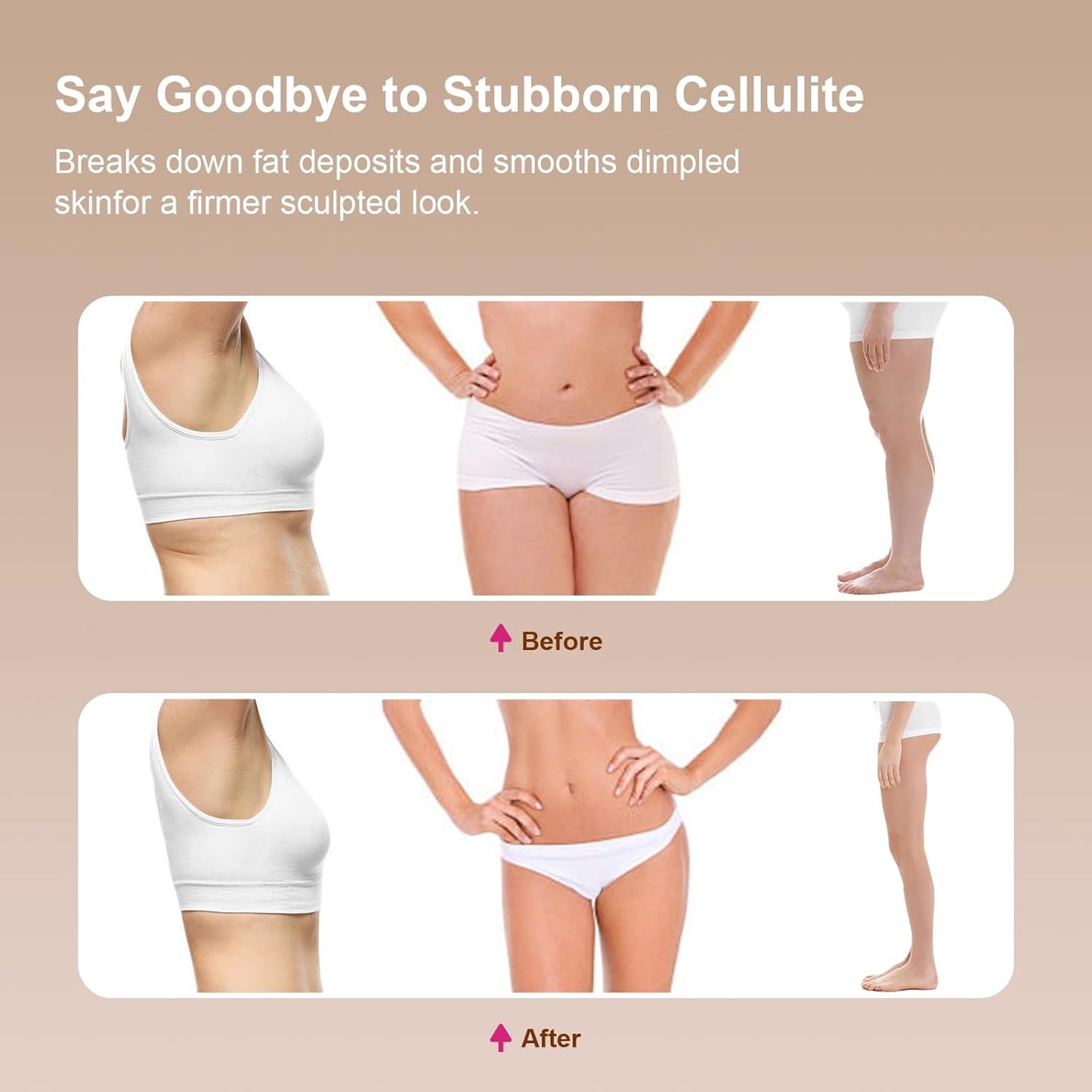 Lymphatic Drainage Massager for Legs, Arms & Belly – Anti Cellulite & Stretch Marks Reduction Tool with Microcurrent, Heat, Vibration & Light Therapy – Portable Body Sculpting Machine for Home Use