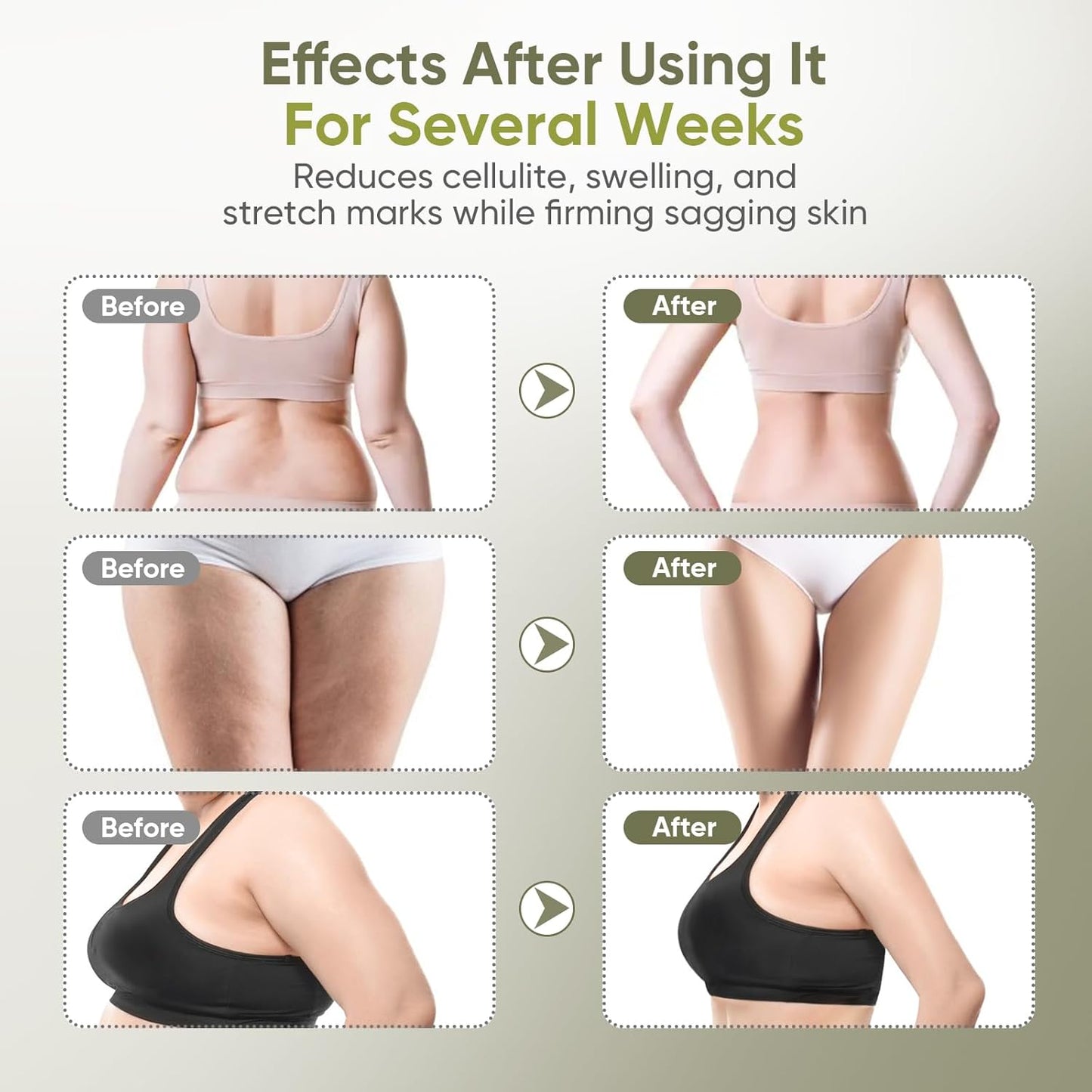 Lymphatic Drainage Massager & Anti Cellulite Massage Tool — Body Sculpting Machinefor Legs, Arms & Belly, Body,Helps Reduce Stretch Marks & Cellulite,with Microcurrent, Light Heat & Vibration