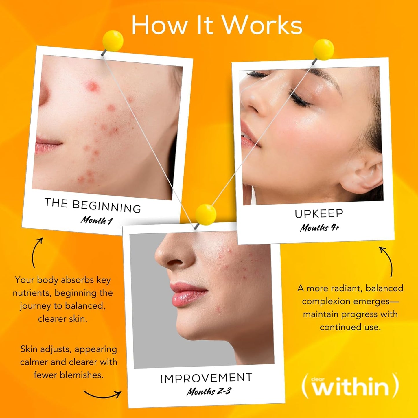 Clear Within Clear Skin Vitamin - with 10 Natural Ingredients for Acne-Free, Clearer Complexion, Oil Control & Blemish Minimization. Supports Skin Clarity | Non-Synthetic 60 Cap/Bottle