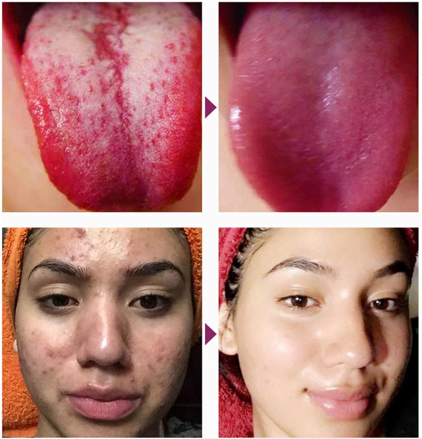 Foot Pads 100 Pieces-Premium Ginger Powder Bamboo Vinegar Feet Pads,Deep Cleansing Foot Patches for Feet Care