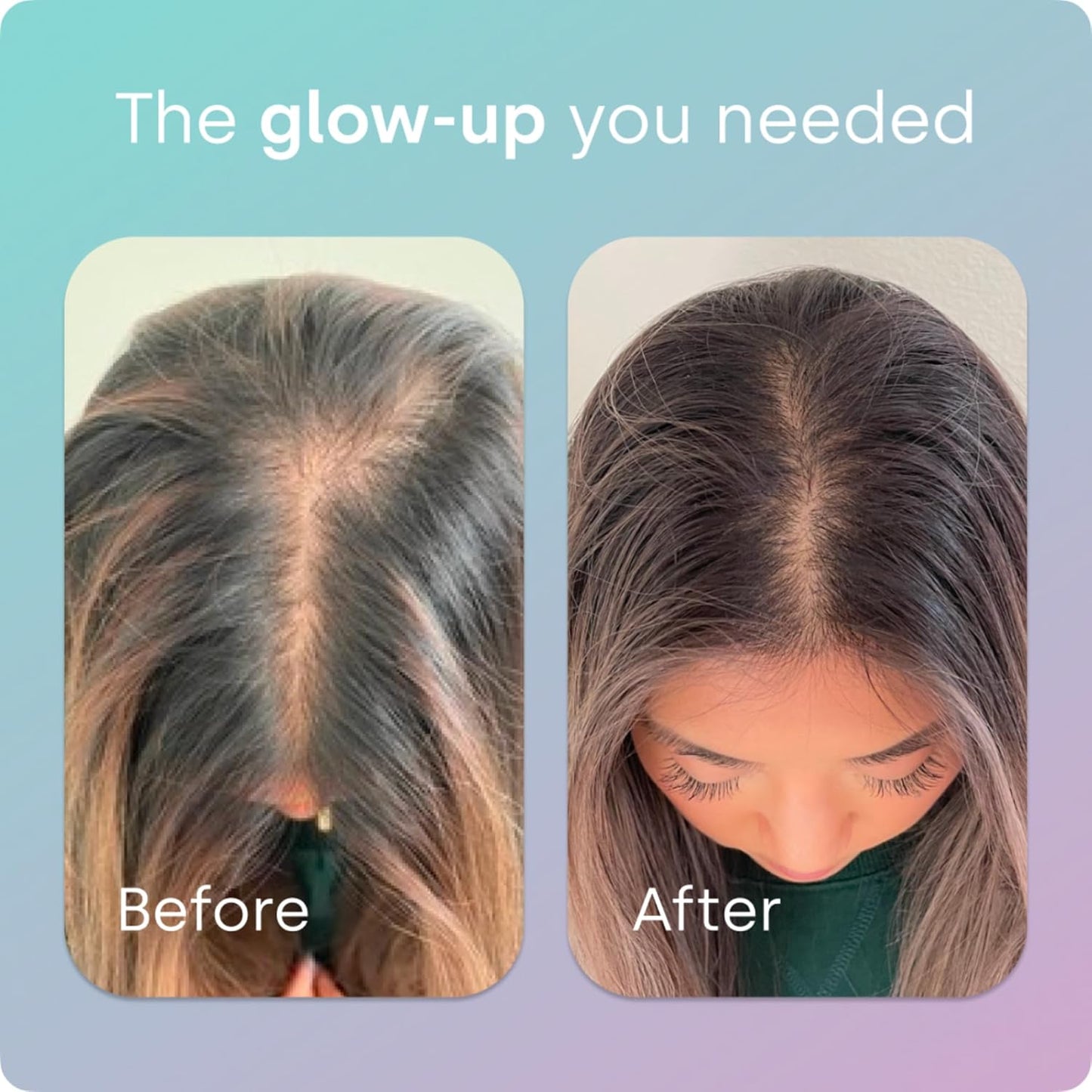 Biosil Advanced Hair + Nail Care - Growth Vitamins for Women - Strengthen & Thicken Strands - 30 Capsules - Patented ch-OSA - 15-Day Supply